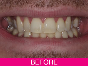 radiant dental chair